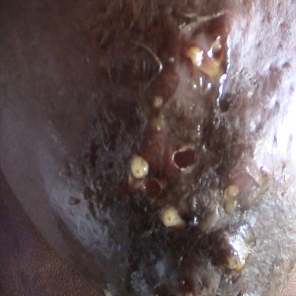 Miasis furuncular causada por Dermatobia hominis