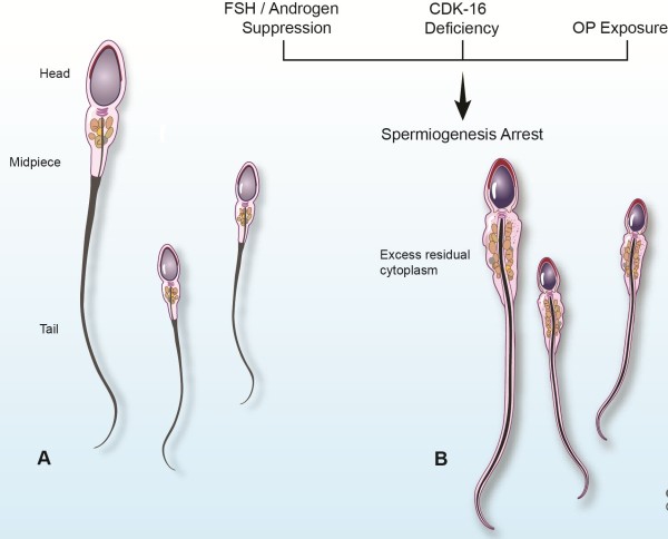 Non Mature Sperm 75